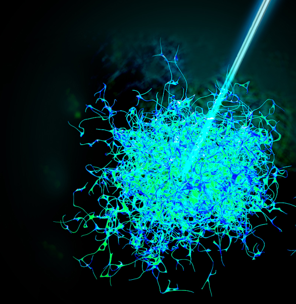 今天，我們把腫瘤的內(nèi)部「融穿」了