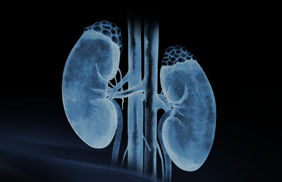 世界腎臟日 | 相得「腎」歡，融有術(shù)、精準(zhǔn)適形